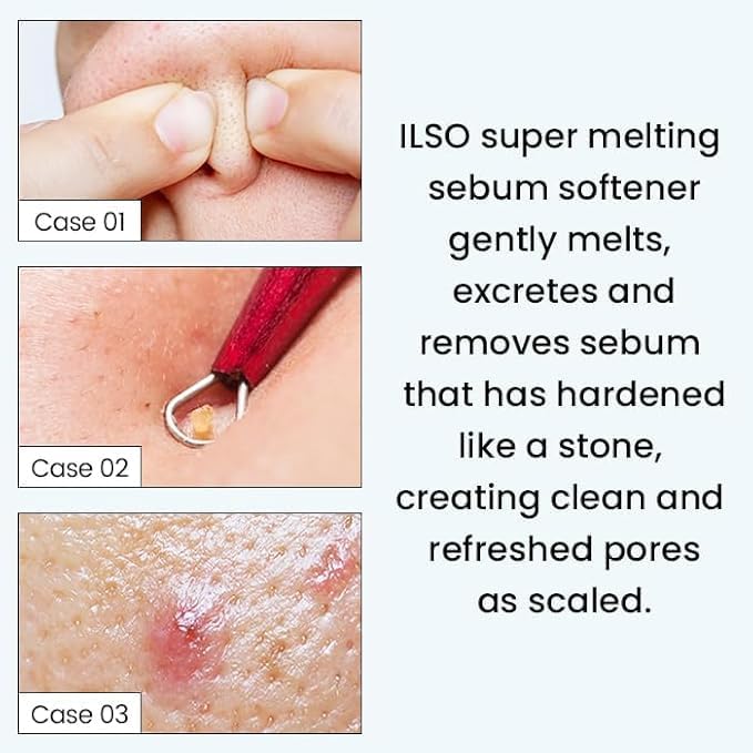 Ilso Super Melting Sebum Softener