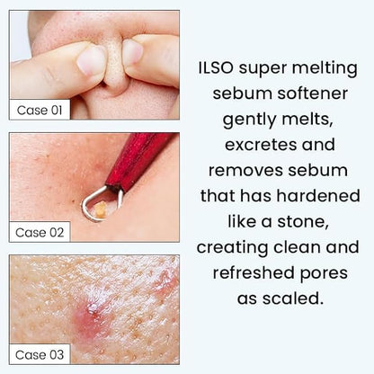 Ilso Super Melting Sebum Softener